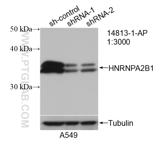 Western Blot (WB) analysis of A549 cells using HNRNPA2B1 Polyclonal antibody (14813-1-AP)