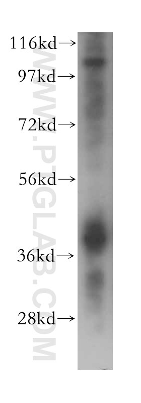 Western Blot (WB) analysis of Jurkat cells using HNRNPA2B1 Polyclonal antibody (14813-1-AP)