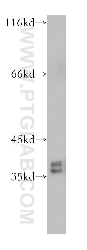 HNRNPA2B1 Polyclonal antibody