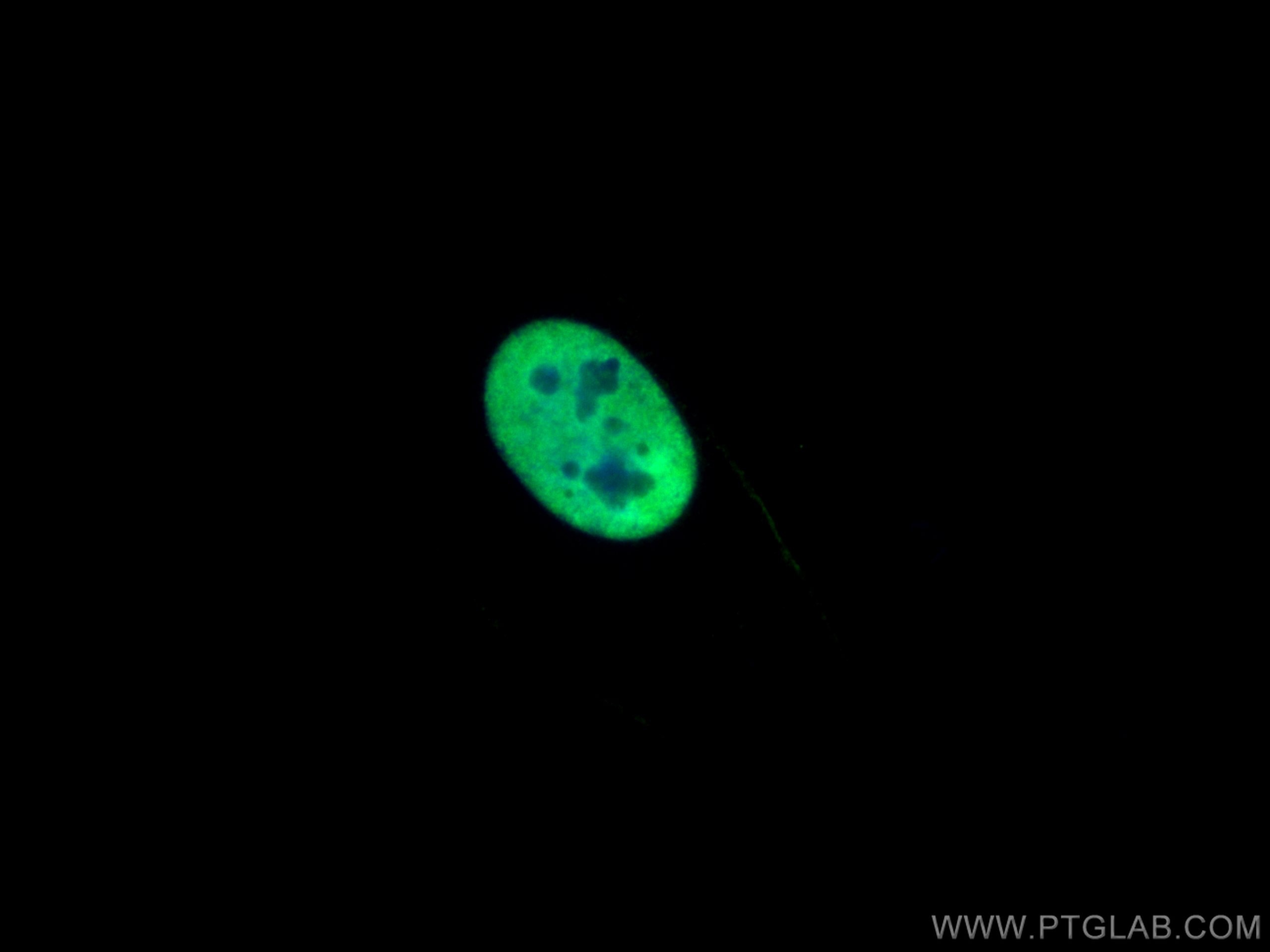 Immunofluorescence (IF) / fluorescent staining of U2OS cells using HNRNPA2B1 Monoclonal antibody (67445-1-Ig)