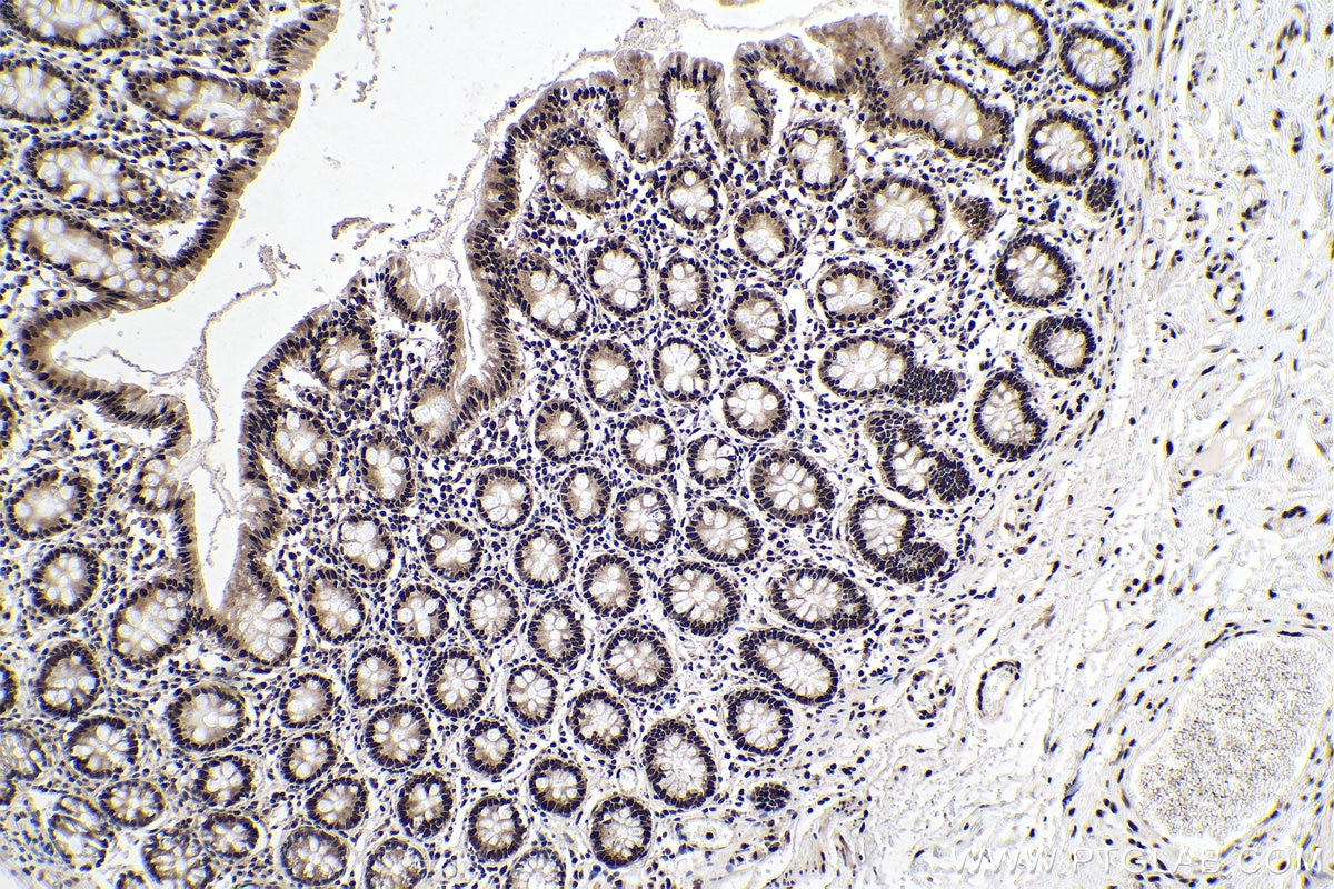 Immunohistochemistry (IHC) staining of human colon tissue using HNRNPA2B1 Monoclonal antibody (67445-1-Ig)