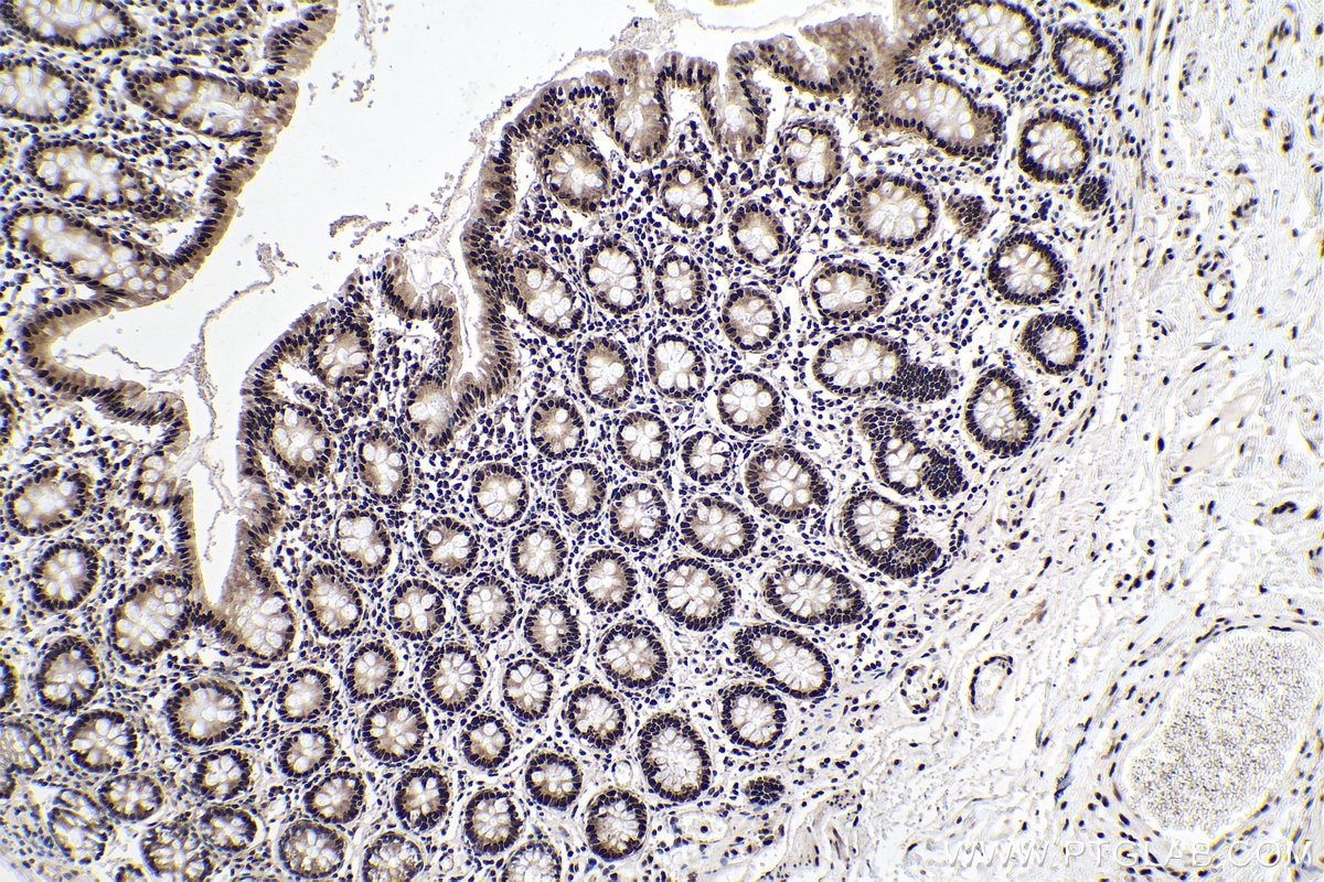 IHC staining of human colon using 67445-1-Ig