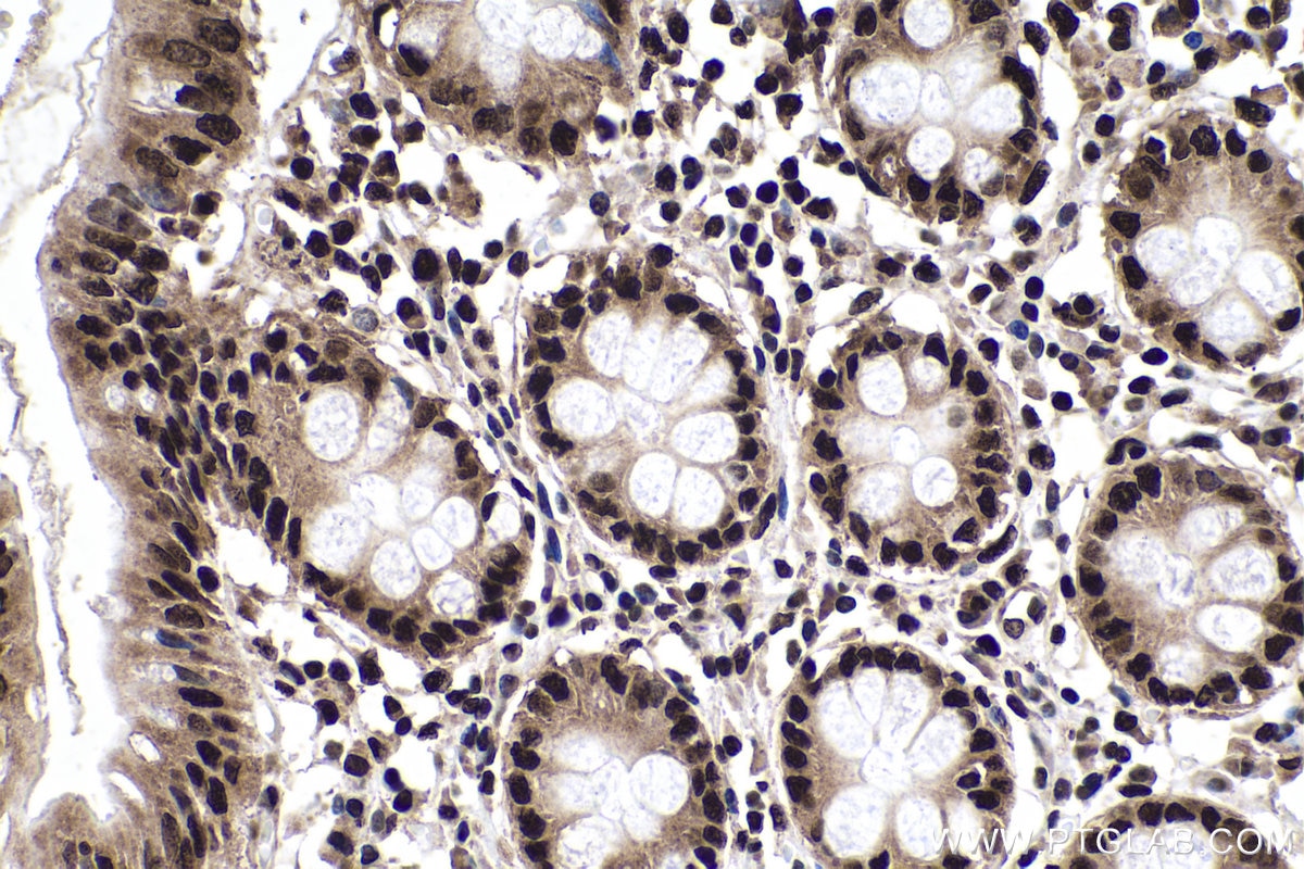 Immunohistochemistry (IHC) staining of human colon tissue using HNRNPA2B1 Monoclonal antibody (67445-1-Ig)