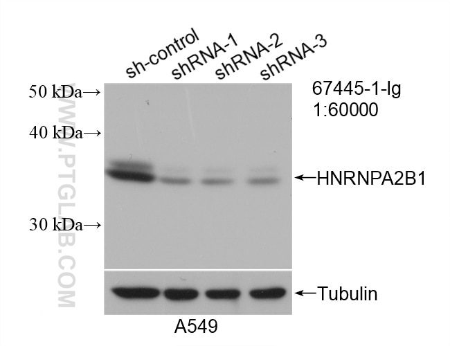 Western Blot (WB) analysis of A549 cells using HNRNPA2B1 Monoclonal antibody (67445-1-Ig)