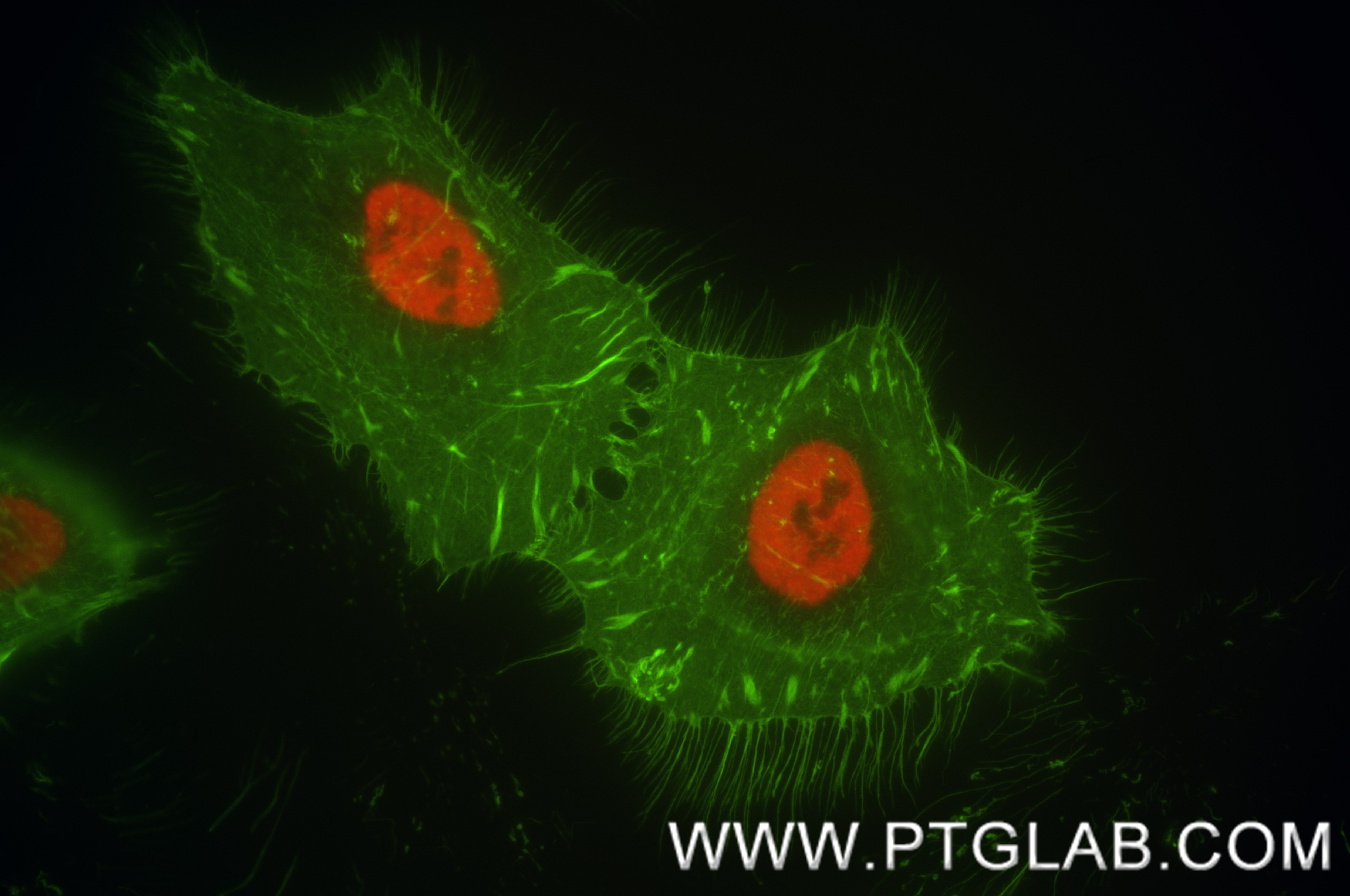 Immunofluorescence (IF) / fluorescent staining of HeLa cells using HNRNPA2B1 Recombinant monoclonal antibody (86713-1-MR)