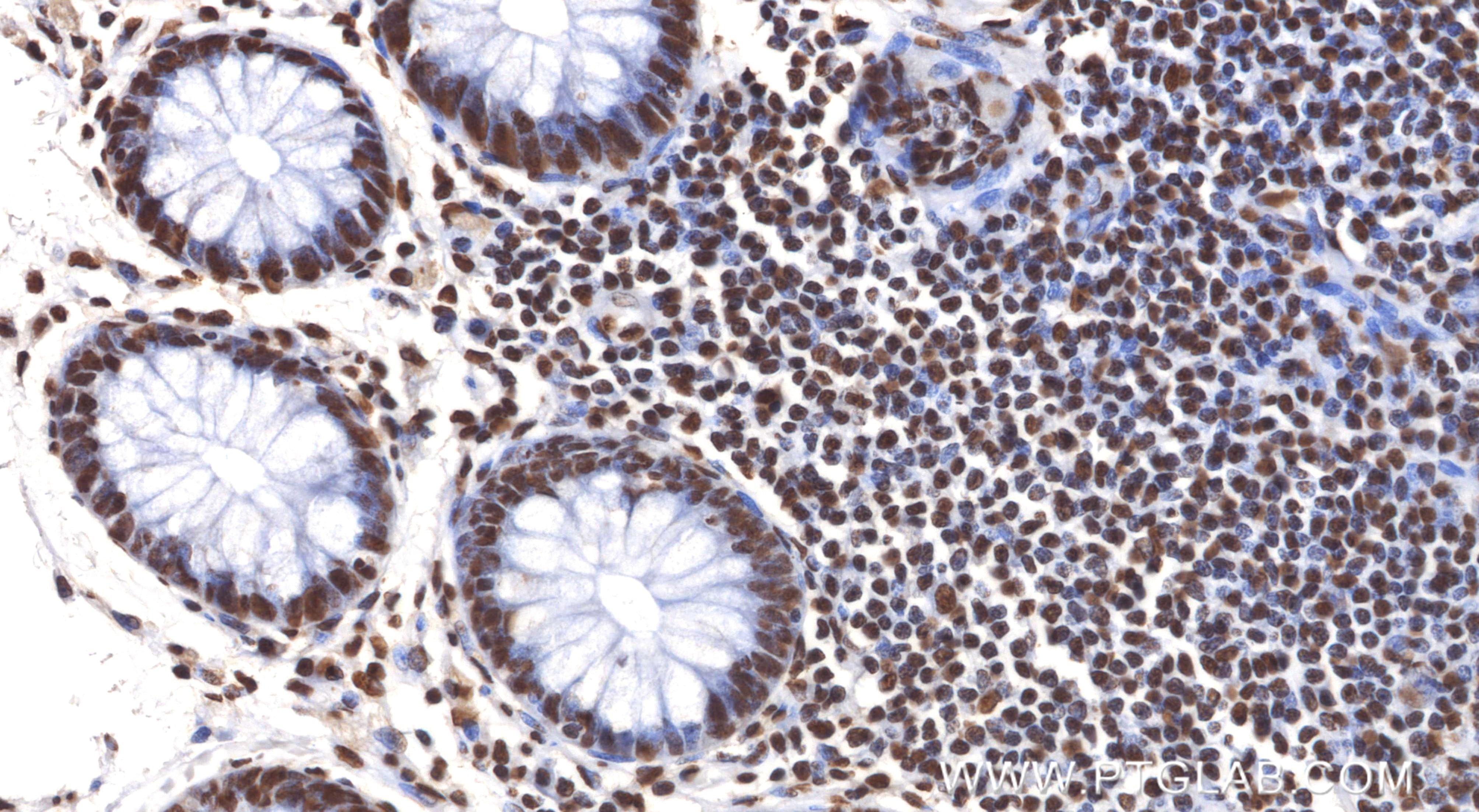 Immunohistochemistry (IHC) staining of human colon tissue using HNRNPA2B1 Recombinant monoclonal antibody (86713-1-MR)
