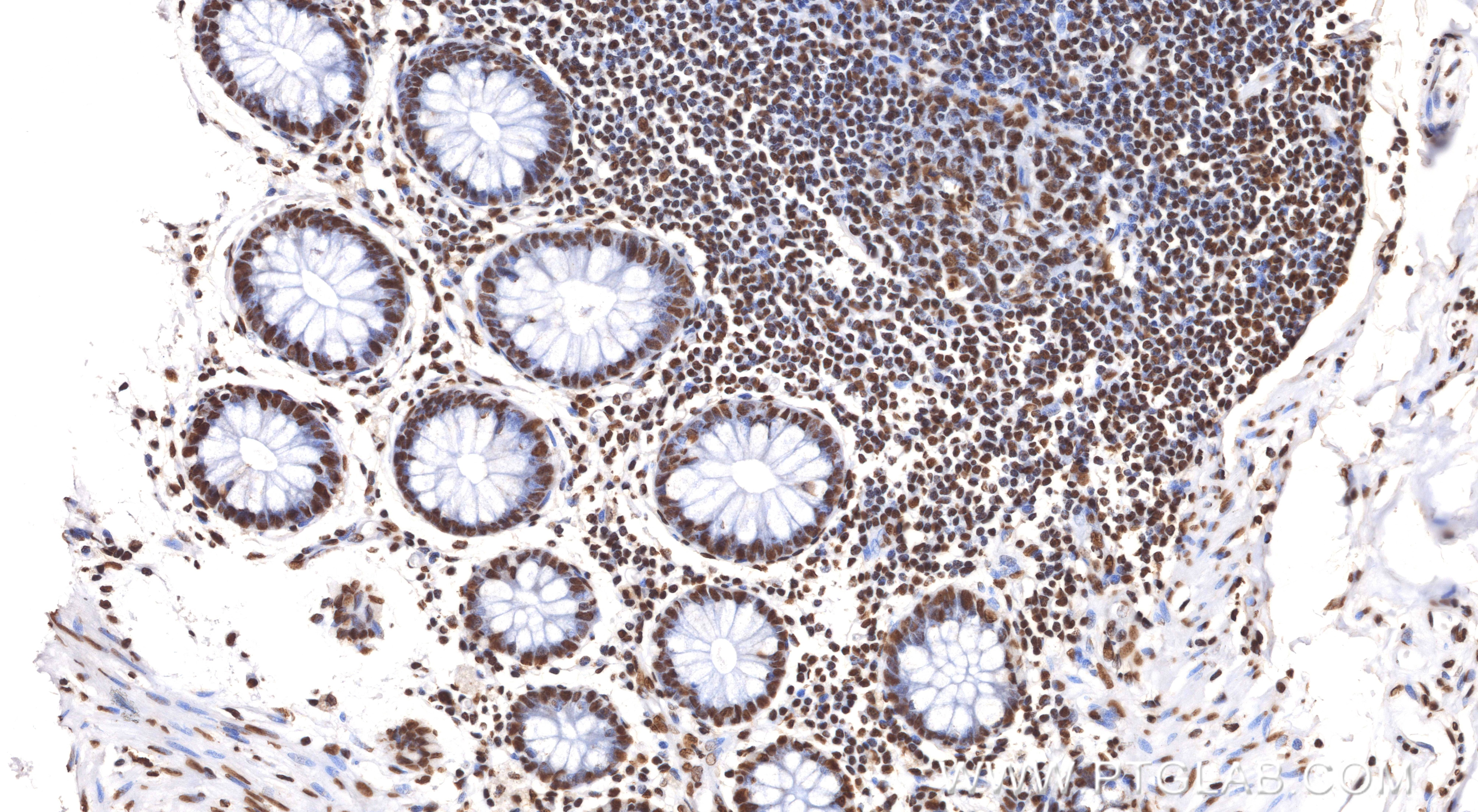 Immunohistochemistry (IHC) staining of human colon tissue using HNRNPA2B1 Recombinant monoclonal antibody (86713-1-MR)