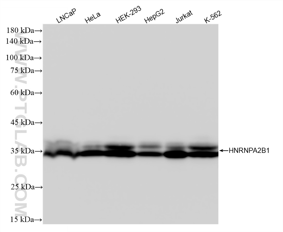 Western Blot (WB) analysis of various lysates using HNRNPA2B1 Recombinant monoclonal antibody (86713-1-MR)