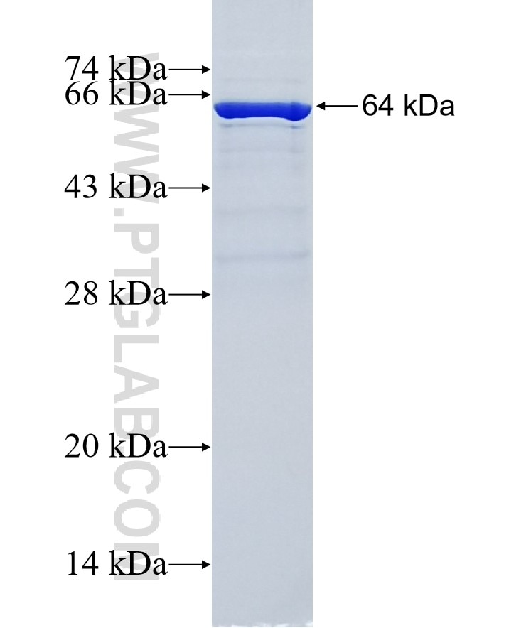 HNRNPA2B1 fusion protein Ag6563 SDS-PAGE