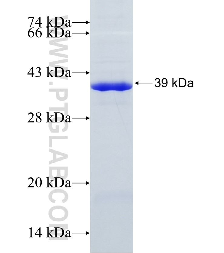 HNRNPA2B1 fusion protein Ag6699 SDS-PAGE