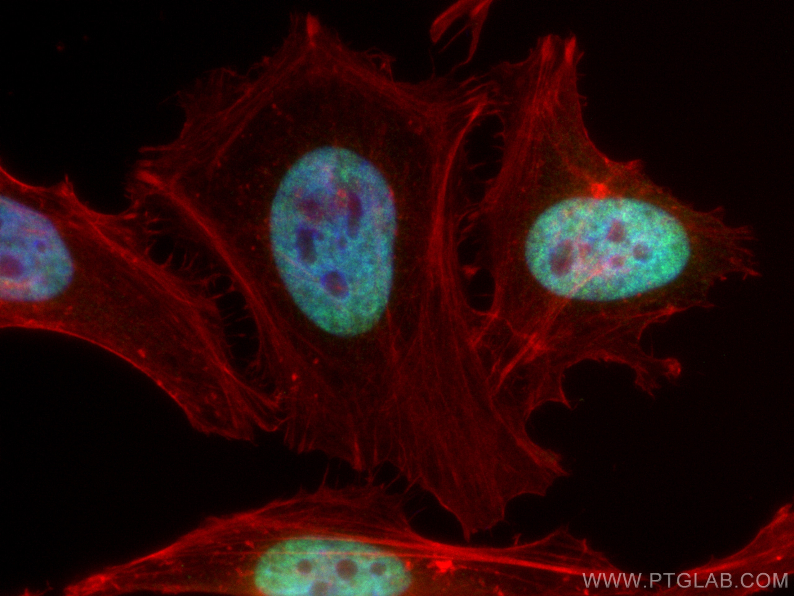 Immunofluorescence (IF) / fluorescent staining of HeLa cells using HNRNPA3 Polyclonal antibody (25142-1-AP)