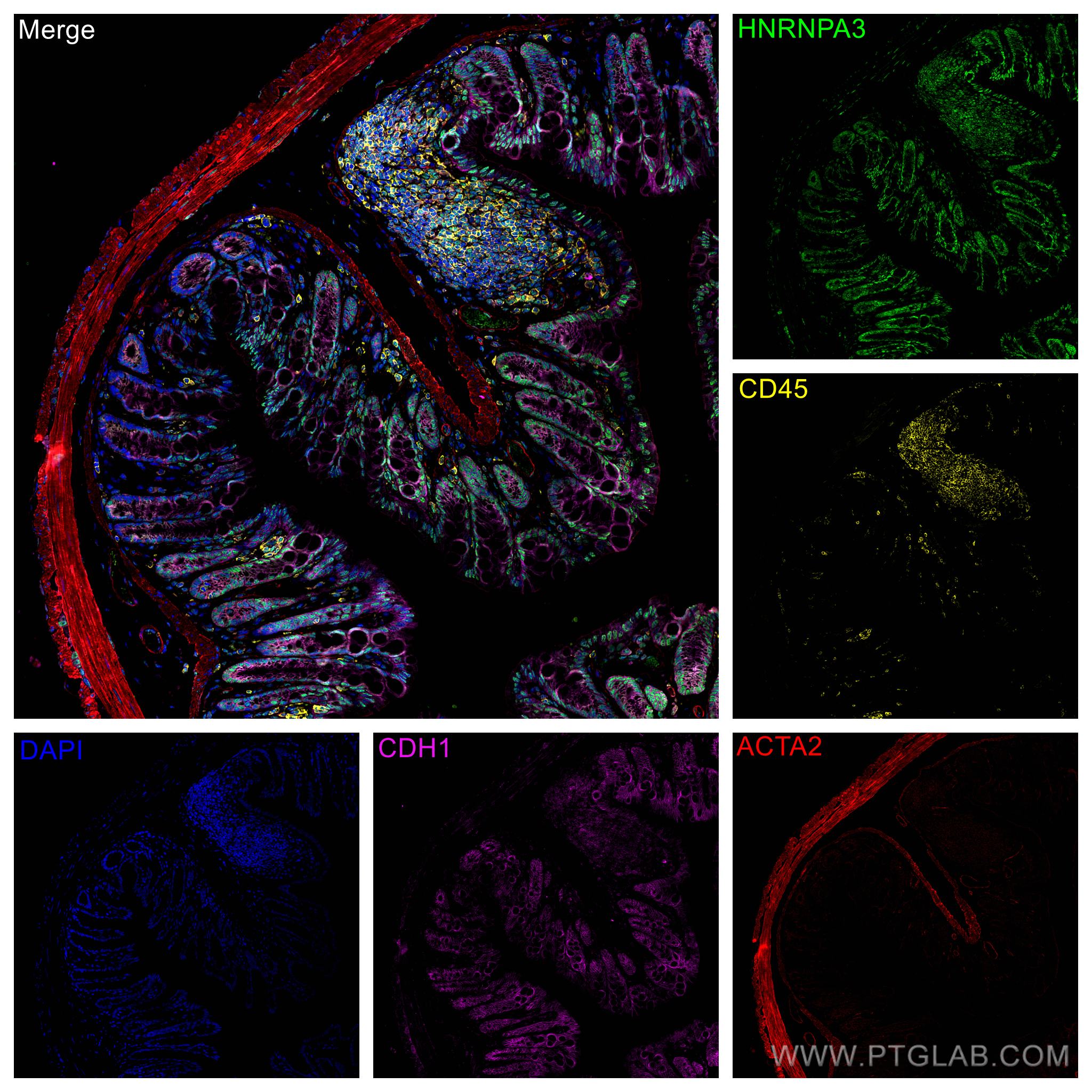 Immunofluorescence (IF) / fluorescent staining of mouse colon tissue using HNRNPA3 Polyclonal antibody (25142-1-AP)