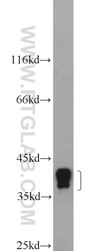 Western Blot (WB) analysis of HeLa cells using HNRNPA3 Polyclonal antibody (25142-1-AP)