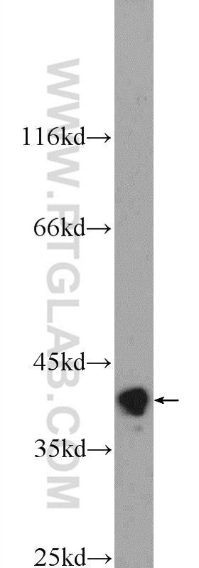 Western Blot (WB) analysis of Jurkat cells using HNRNPA3 Polyclonal antibody (25142-1-AP)