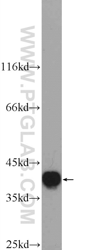 Western Blot (WB) analysis of mouse liver tissue using HNRNPA3 Polyclonal antibody (25142-1-AP)