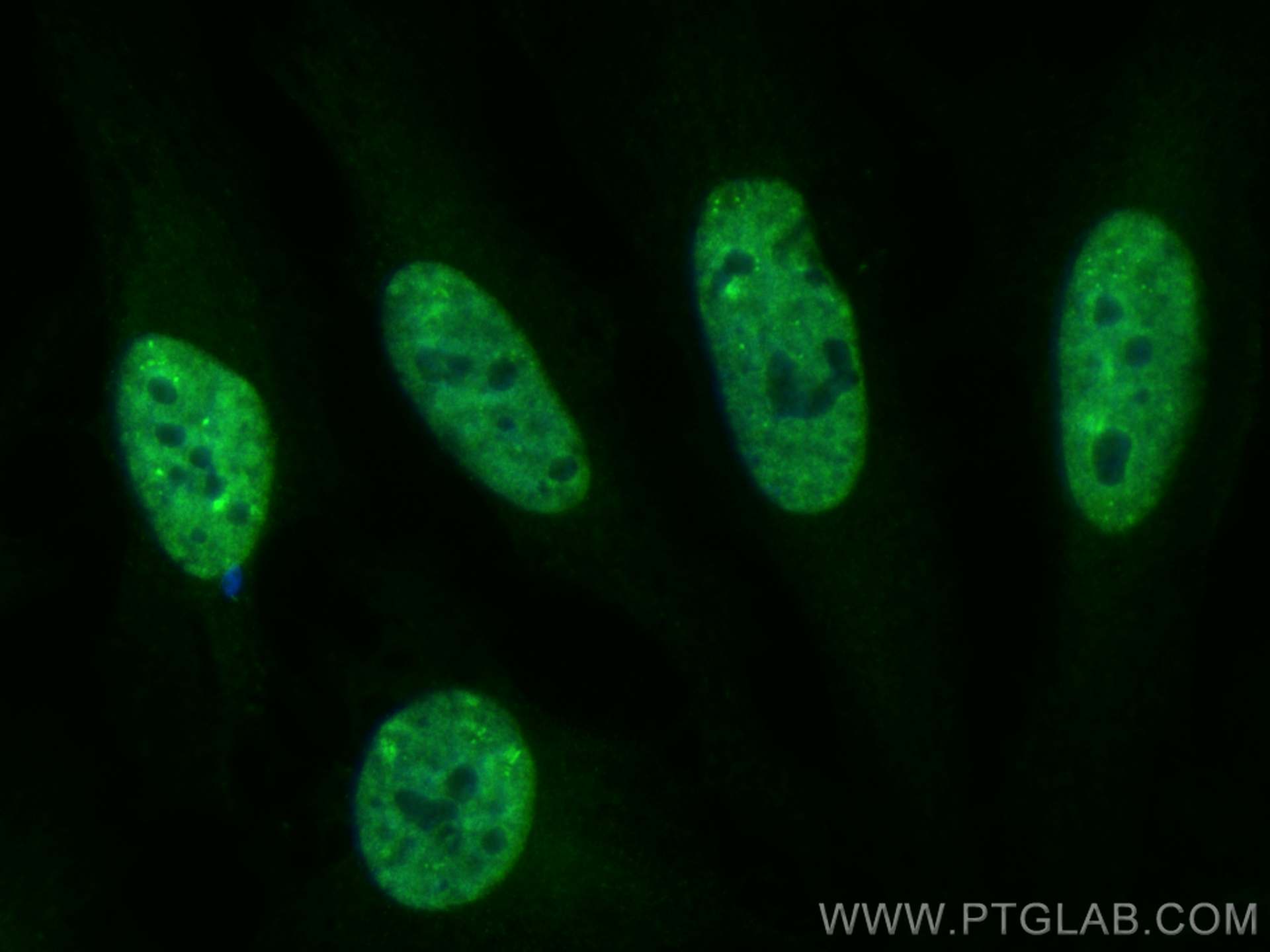 Immunofluorescence (IF) / fluorescent staining of HeLa cells using CoraLite® Plus 488-conjugated HNRNPA3 Polyclonal a (CL488-25142)
