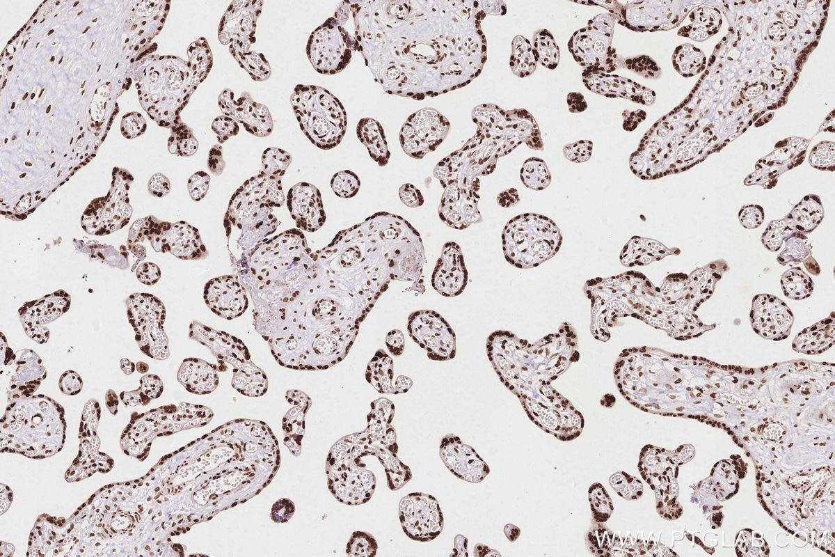 IHC staining of human placenta using 84207-1-RR Immunohistochemistry (IHC) staining of human placenta tissue using HNRNPAB Recombinant monoclonal antibody (84207-1-RR)