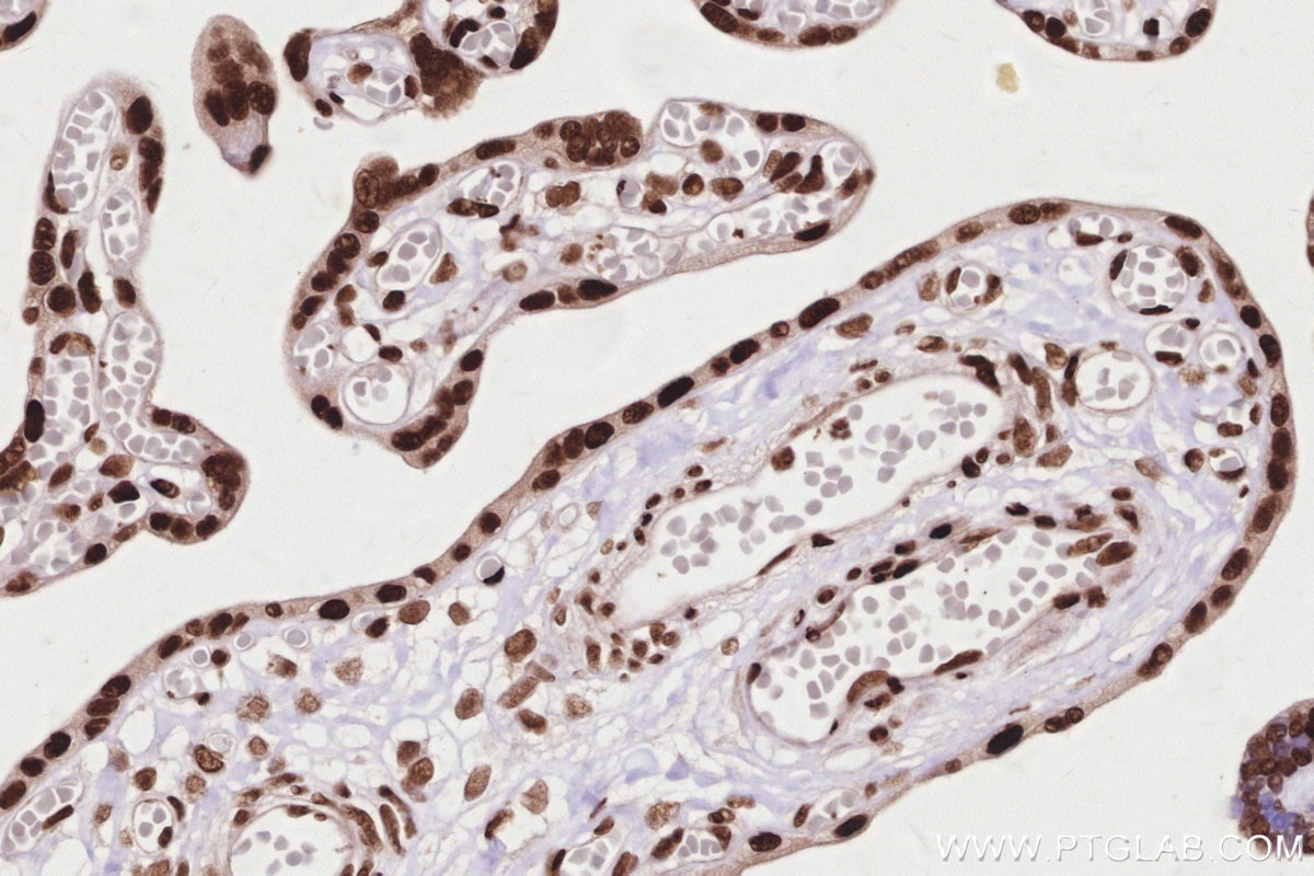 IHC staining of human placenta using 84207-1-RR Immunohistochemistry (IHC) staining of human placenta tissue using HNRNPAB Recombinant monoclonal antibody (84207-1-RR)