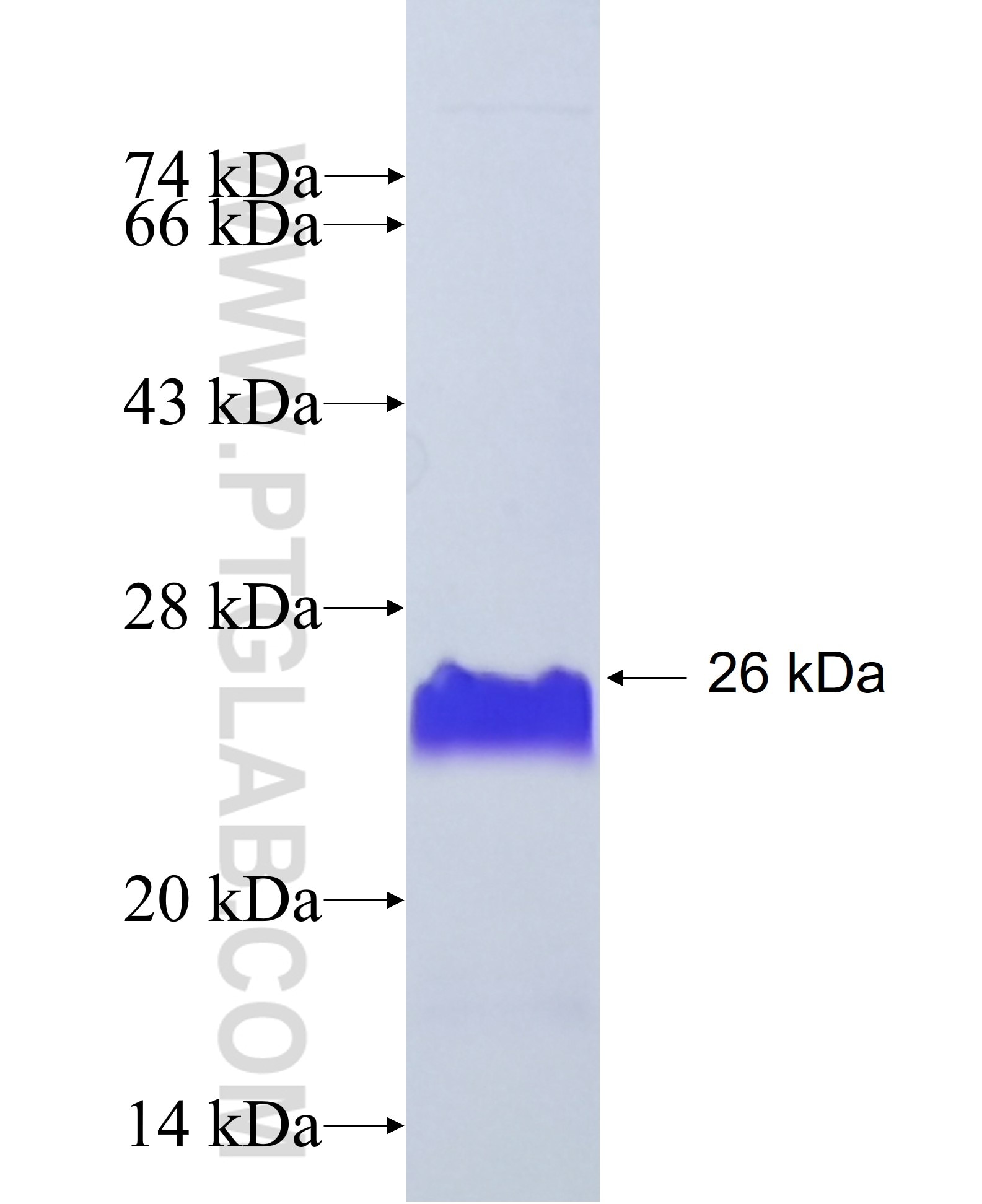 HNRNPAB fusion protein Ag35020 SDS-PAGE HNRNPAB fusion protein Ag35020 SDS-PAGE