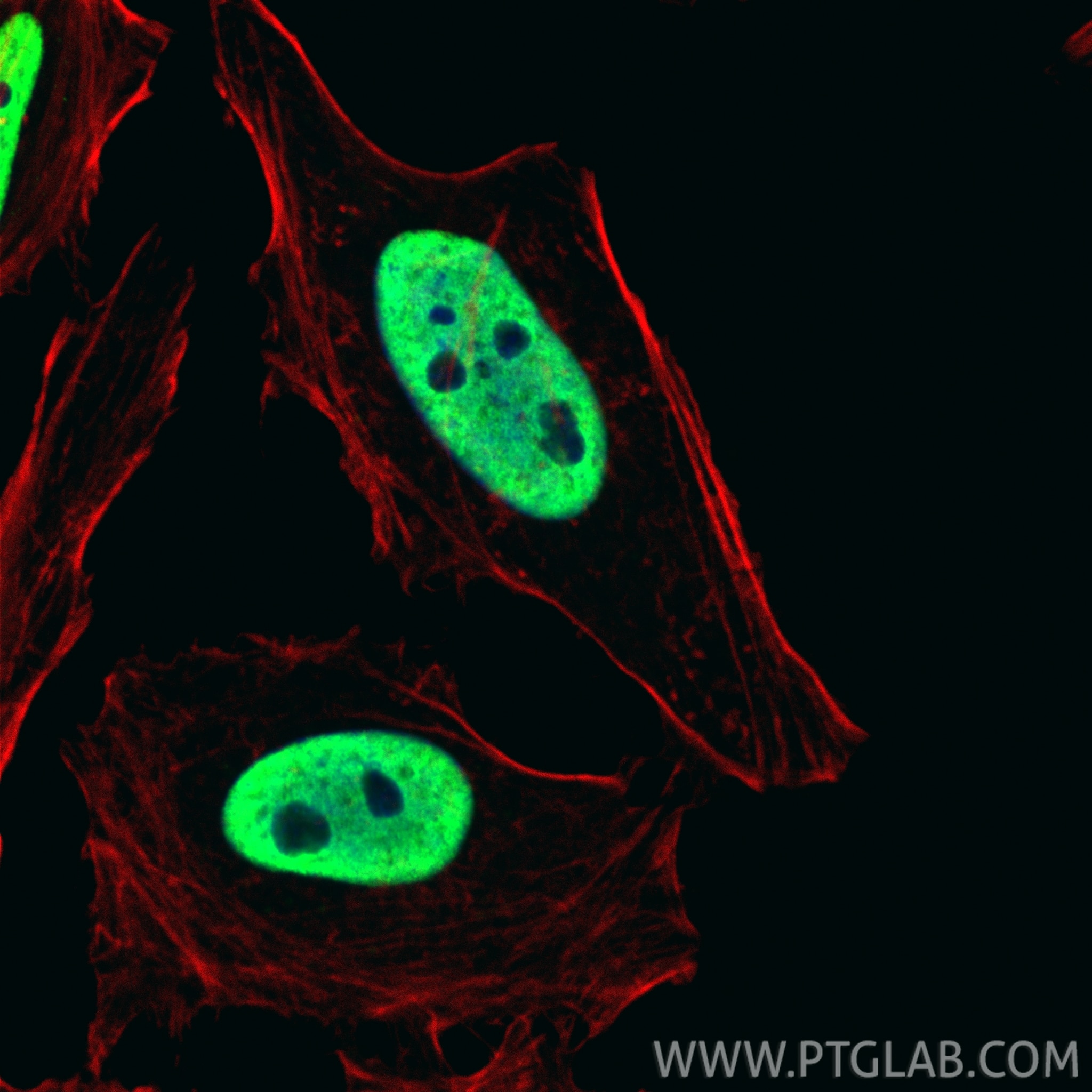 IF Staining of HeLa using 11760-1-AP Immunofluorescence (IF) / fluorescent staining of HeLa cells using HNRNPC Polyclonal antibody (11760-1-AP)