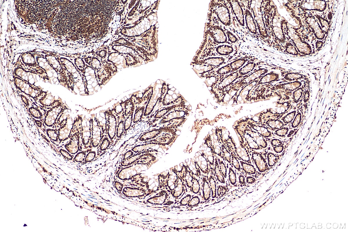 Immunohistochemistry (IHC) staining of mouse colon tissue using HNRNPC Polyclonal antibody (11760-1-AP)