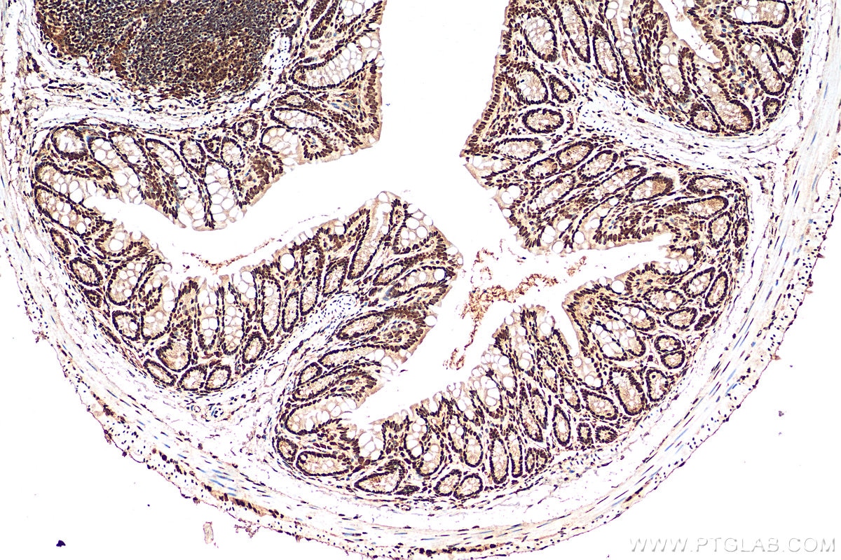 IHC staining of mouse colon using 11760-1-AP