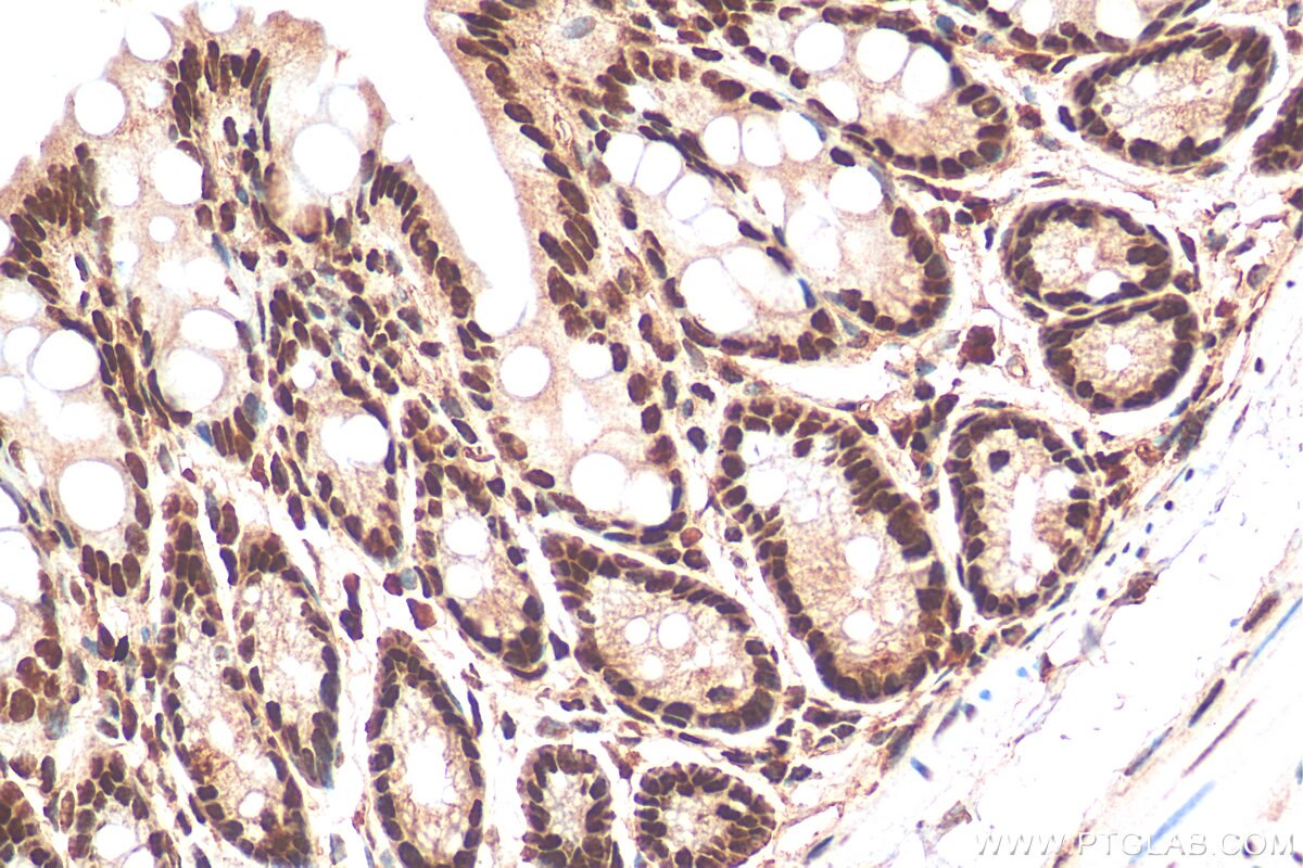 Immunohistochemistry (IHC) staining of mouse colon tissue using HNRNPC Polyclonal antibody (11760-1-AP)