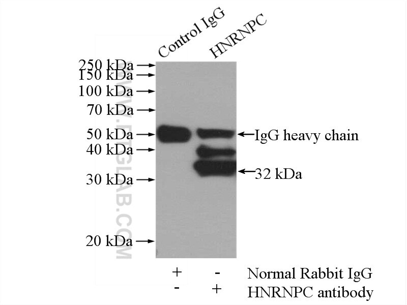 Immunoprecipitation (IP) experiment of HeLa cells using HNRNPC Polyclonal antibody (11760-1-AP)