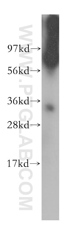 Western Blot (WB) analysis of human brain tissue using HNRNPC Polyclonal antibody (11760-1-AP)