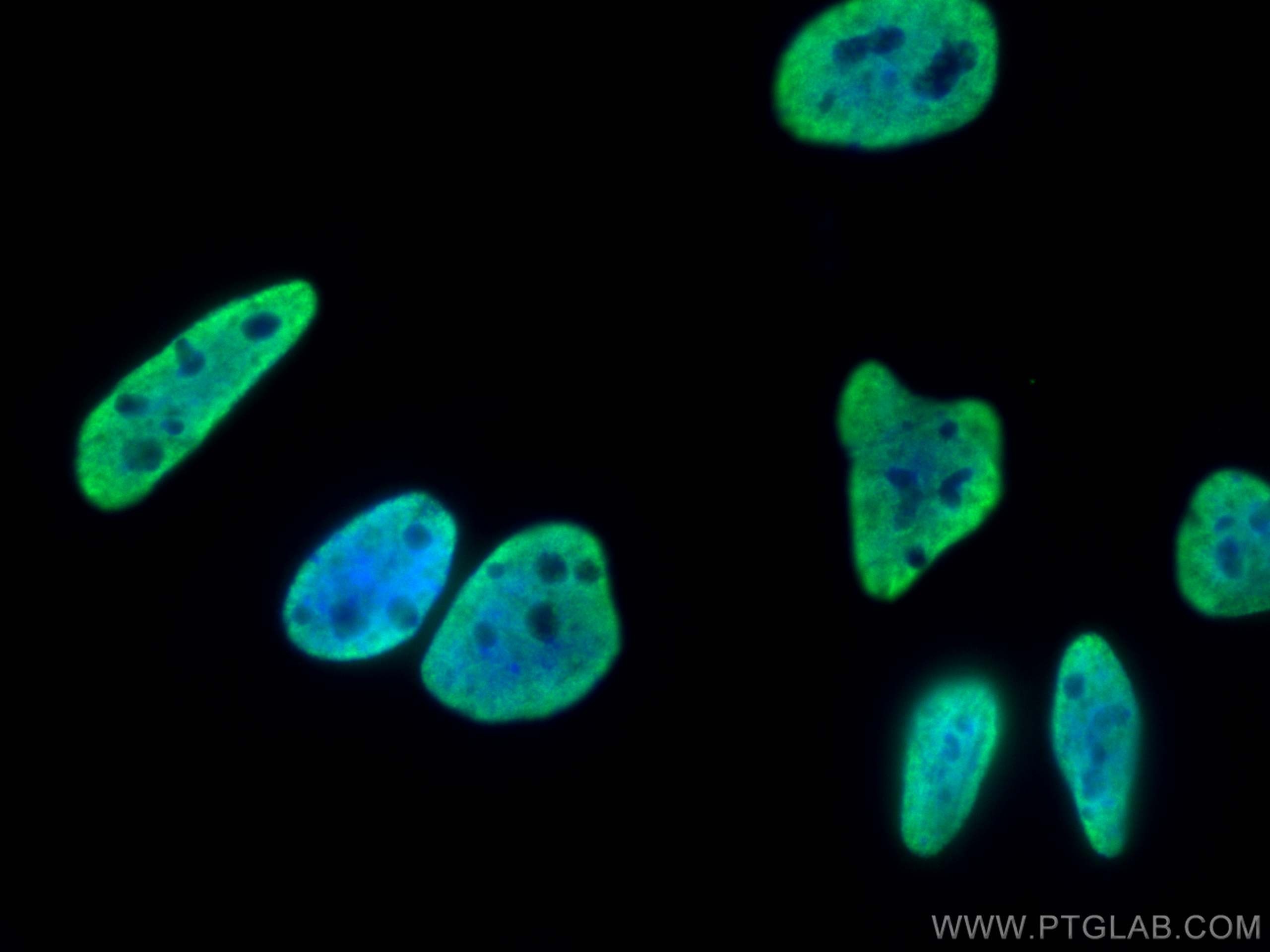 Immunofluorescence (IF) / fluorescent staining of HeLa cells using HNRNPC Monoclonal antibody (68447-1-Ig)