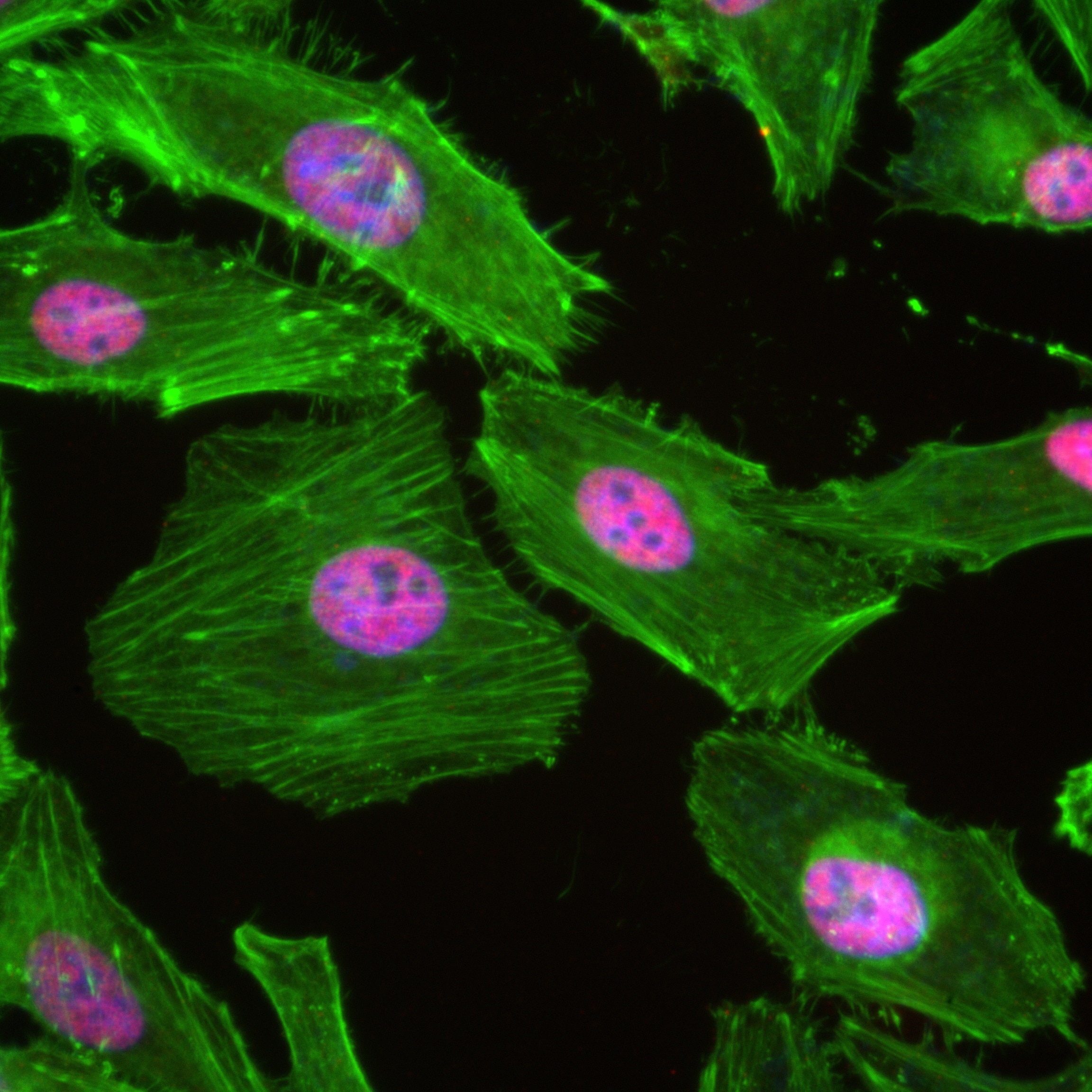 Immunofluorescence (IF) / fluorescent staining of HeLa cells using HNRNPC Recombinant antibody (82798-3-RR)