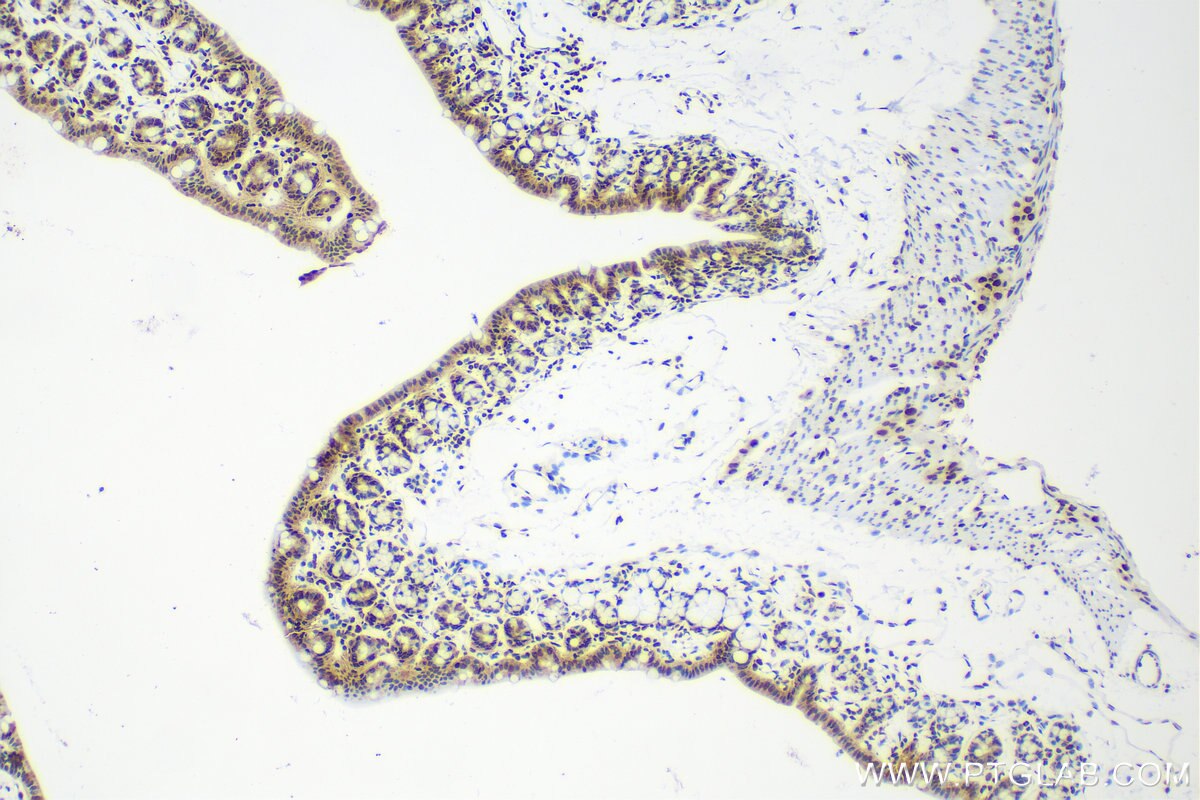 Immunohistochemistry (IHC) staining of mouse colon tissue using HNRNPC Recombinant antibody (82798-3-RR)