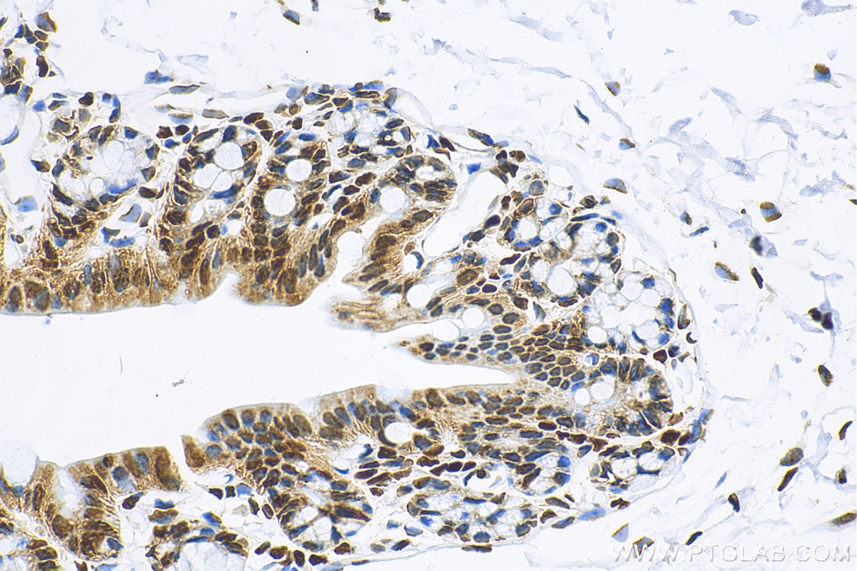 Immunohistochemistry (IHC) staining of mouse colon tissue using HNRNPC Recombinant antibody (82798-3-RR)