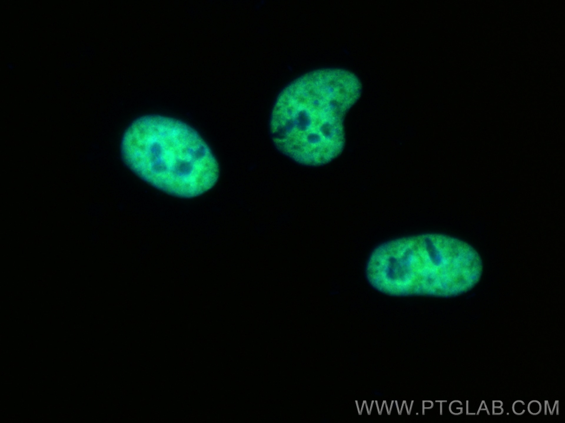 IF Staining of HeLa using CL488-68447