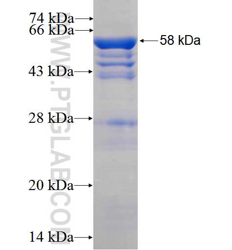 HNRNPC fusion protein Ag2356 SDS-PAGE