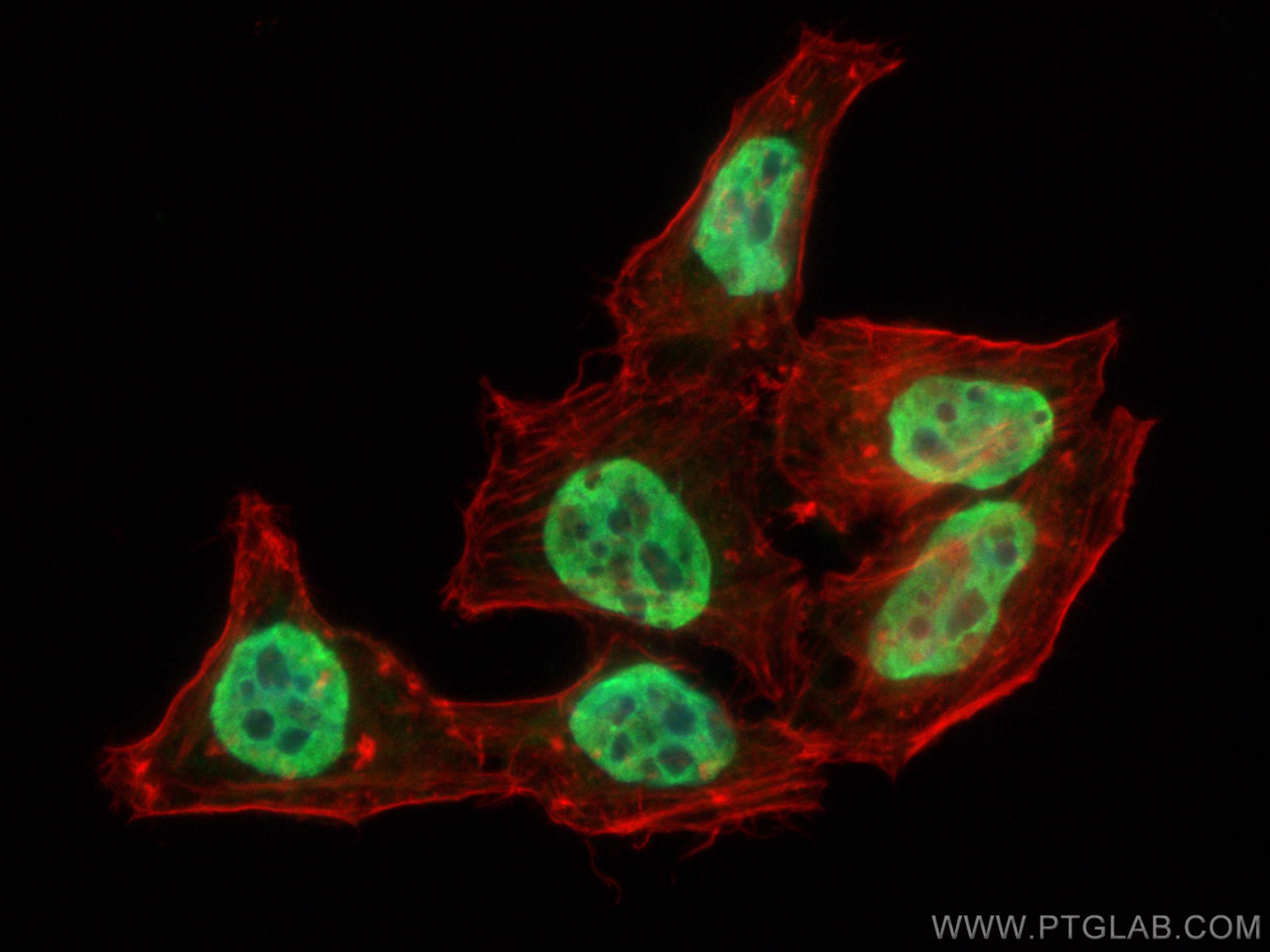 Immunofluorescence (IF) / fluorescent staining of HepG2 cells using HNRNPD Polyclonal antibody (12770-1-AP)
