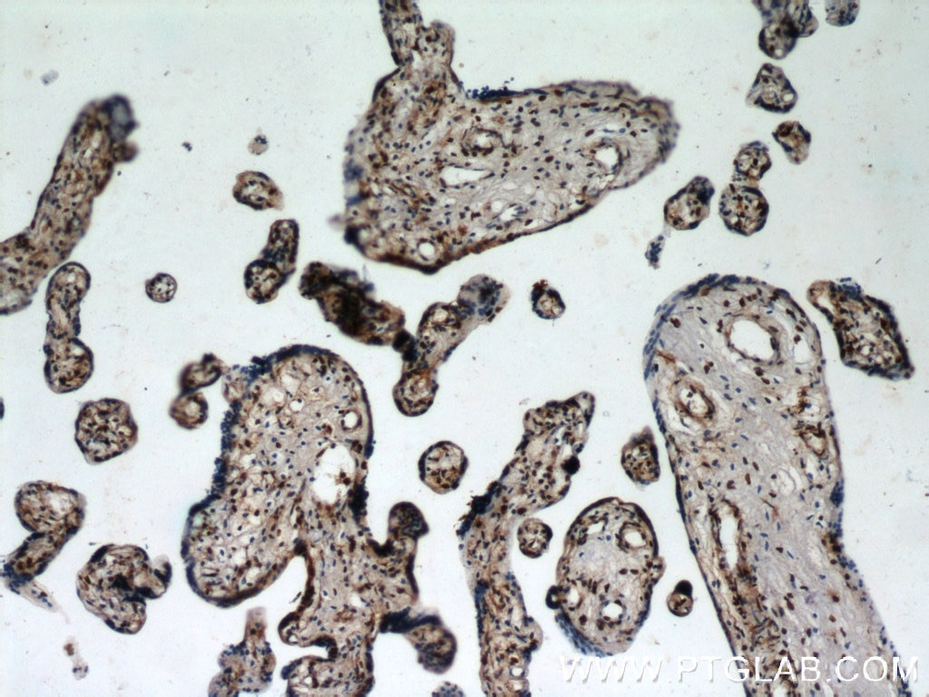 IHC staining of human placenta using 12770-1-AP