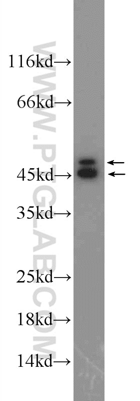 Western Blot (WB) analysis of Jurkat cells using HNRNPD Polyclonal antibody (12770-1-AP)