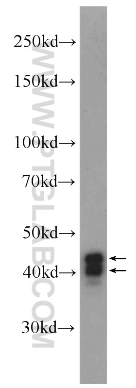 Western Blot (WB) analysis of Jurkat cells using HNRNPD Polyclonal antibody (12770-1-AP)