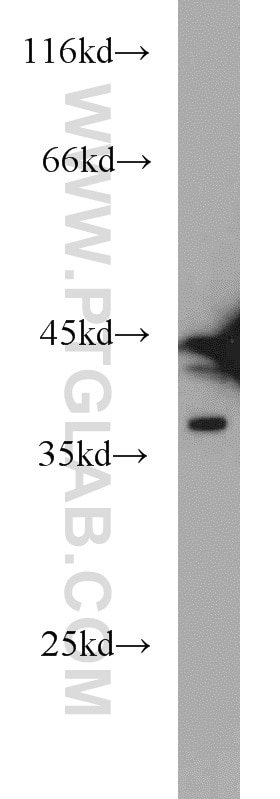 Western Blot (WB) analysis of HeLa cells using HNRNPD Polyclonal antibody (12770-1-AP)