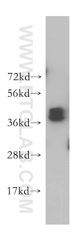 WB analysis of HeLa using 12770-1-AP