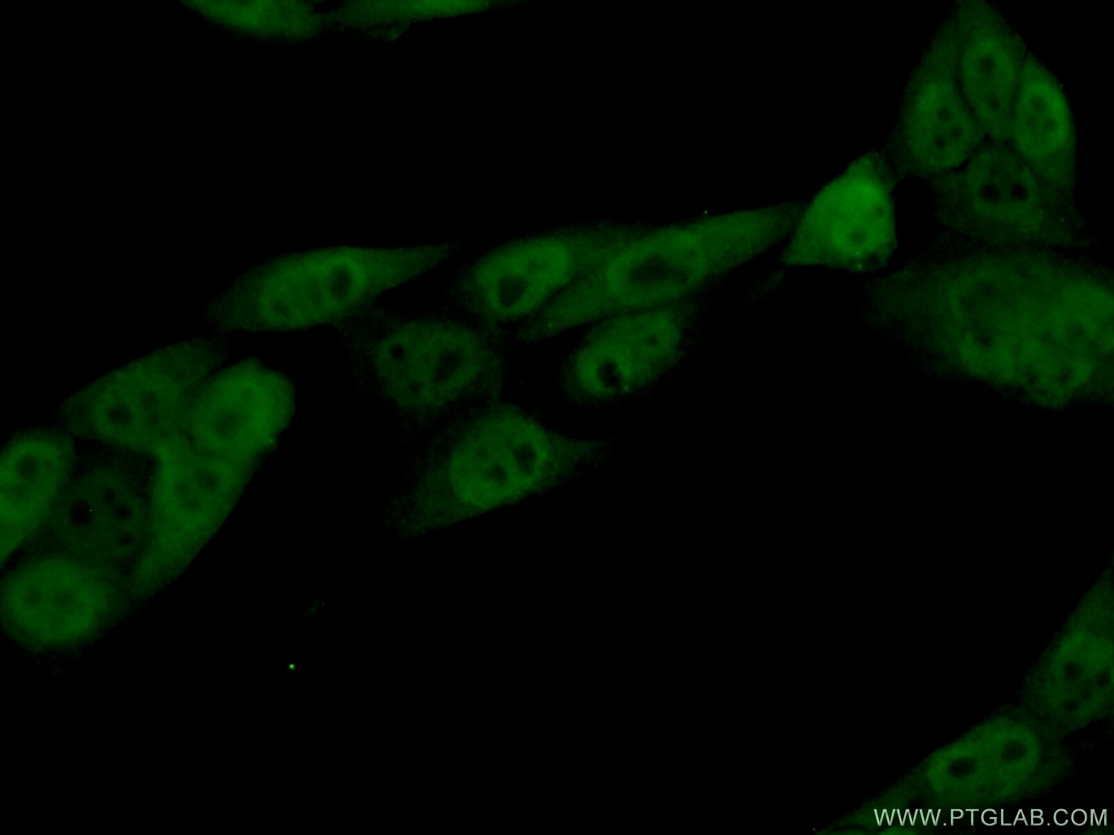 Immunofluorescence (IF) / fluorescent staining of HeLa cells using HNRNPF Polyclonal antibody (14974-1-AP)