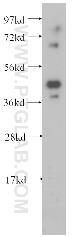 Western Blot (WB) analysis of HeLa cells using HNRNPF Polyclonal antibody (14974-1-AP)