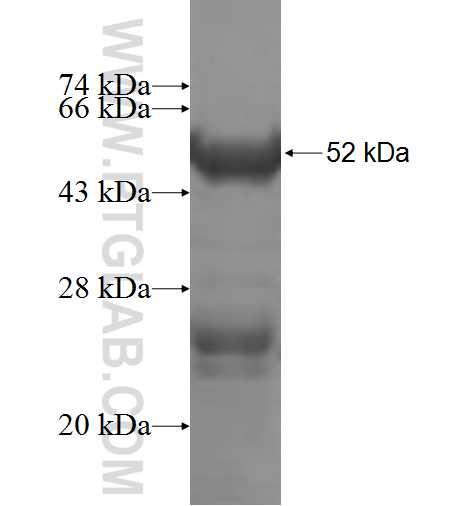 HNRNPF fusion protein Ag7128 SDS-PAGE