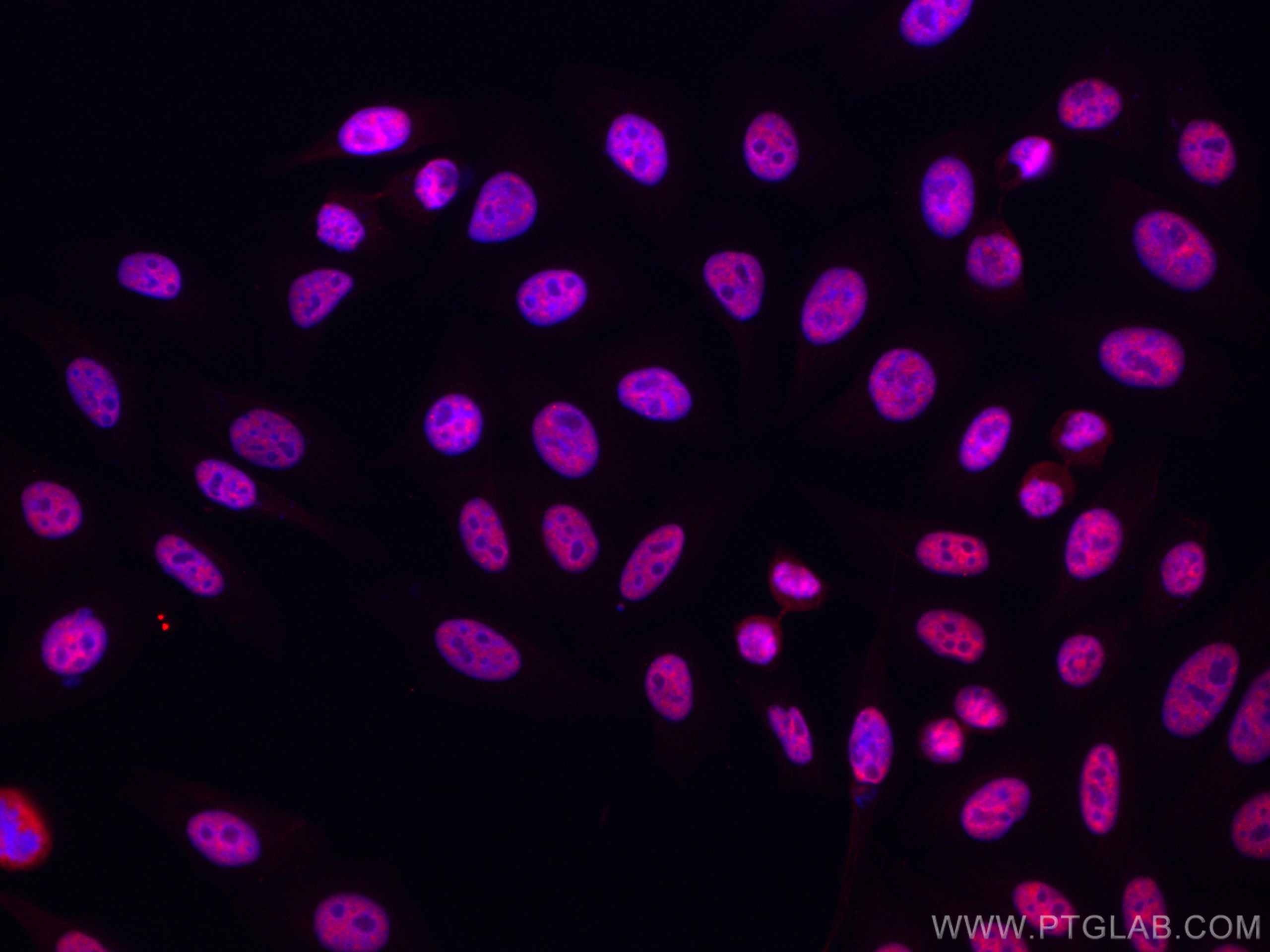 Immunofluorescence (IF) / fluorescent staining of HepG2 cells using CoraLite®594-conjugated HNRNPH1 Monoclonal antibod (CL594-67375)