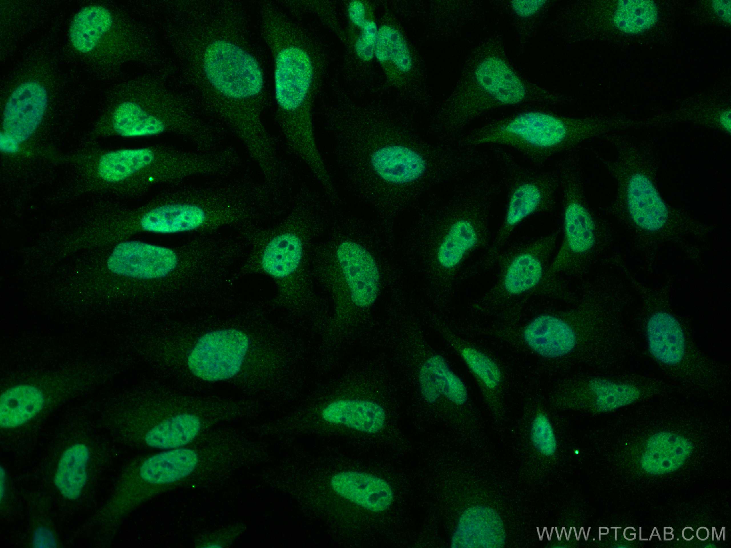 Immunofluorescence (IF) / fluorescent staining of HeLa cells using HNRNPK Polyclonal antibody (11426-1-AP)