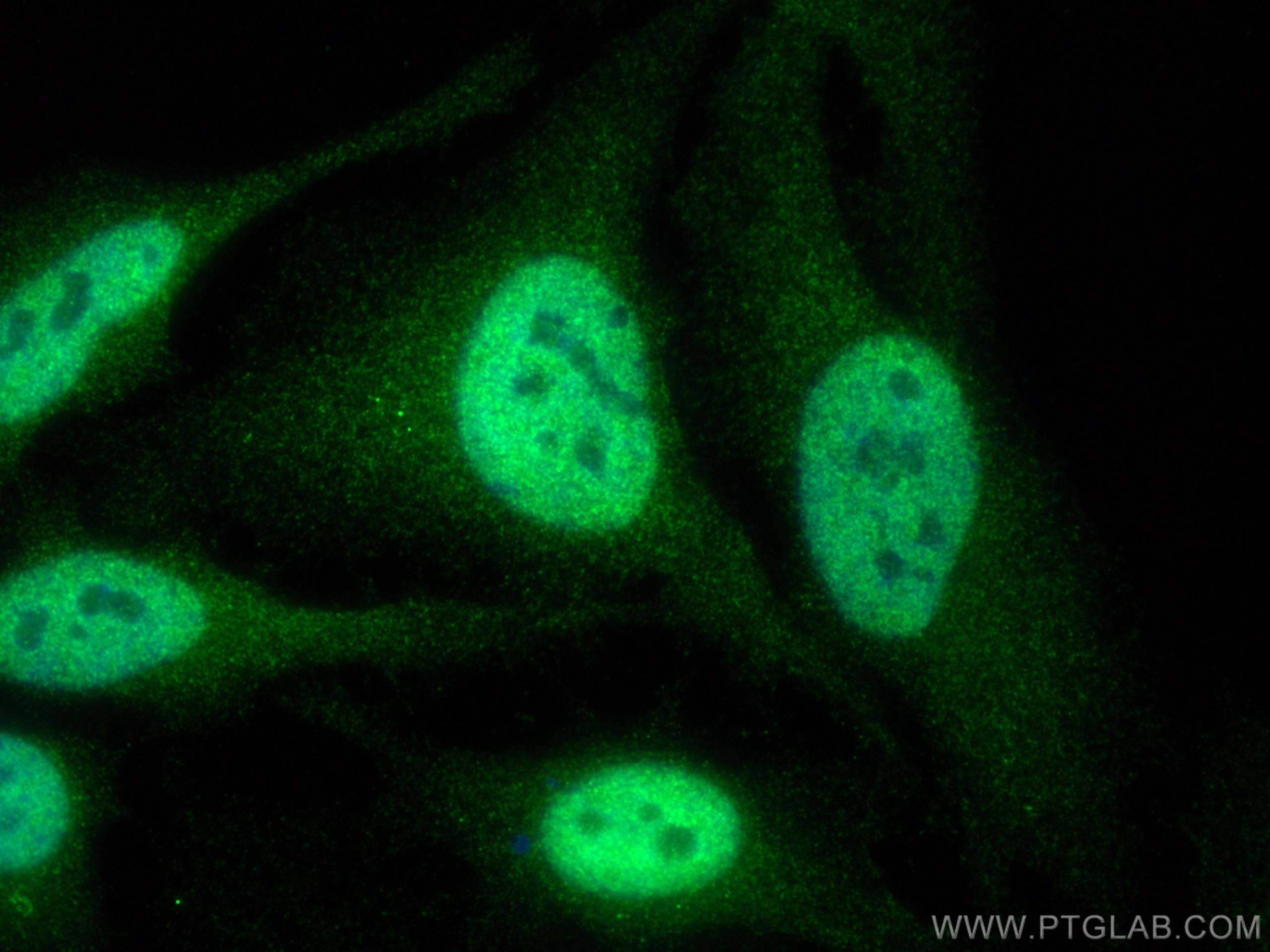 Immunofluorescence (IF) / fluorescent staining of HeLa cells using HNRNPK Polyclonal antibody (11426-1-AP)