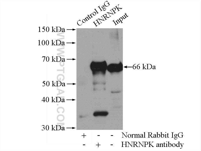 Immunoprecipitation (IP) experiment of HeLa cells using HNRNPK Polyclonal antibody (11426-1-AP)