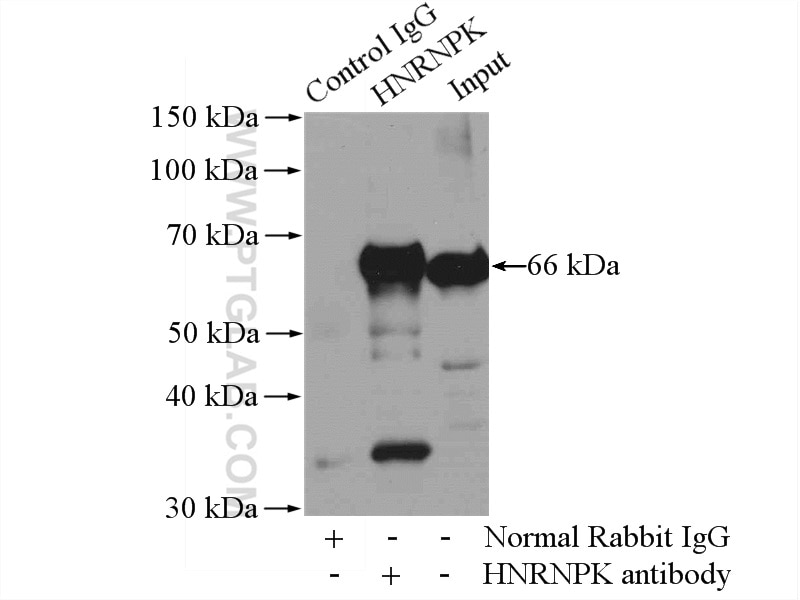 IP experiment of HeLa using 11426-1-AP