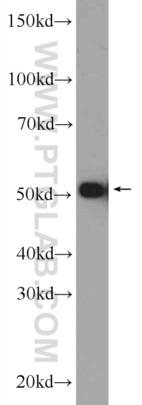 Western Blot (WB) analysis of MCF-7 cells using HNRNPK Polyclonal antibody (11426-1-AP)